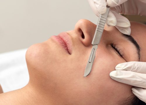 Photo of a woman getting dermaplaning treatments