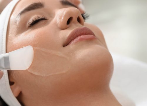 Photo of a woman getting a Signature Peel