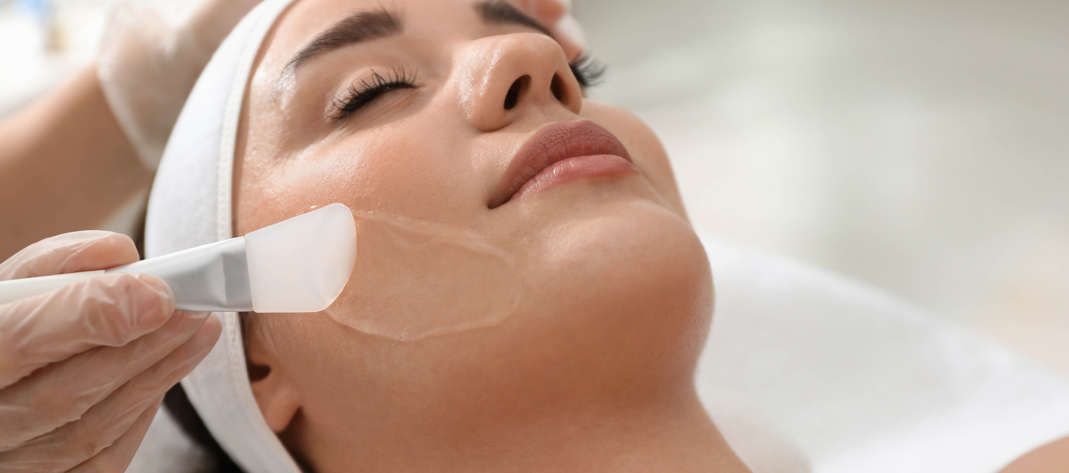 Chemical Peel
