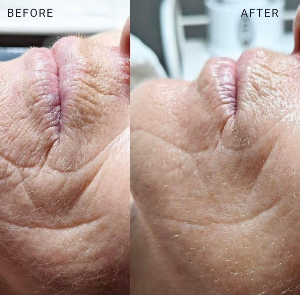 Before and after results