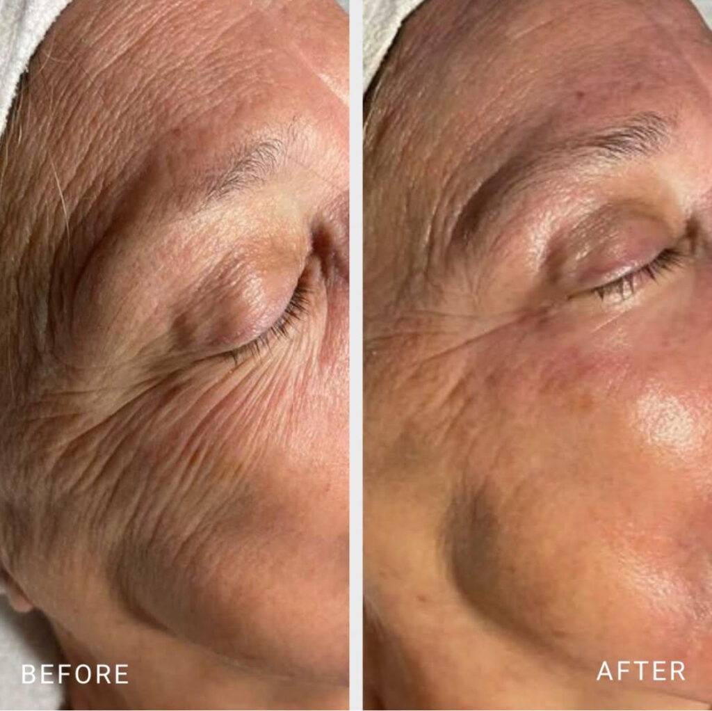 Before and after result photos