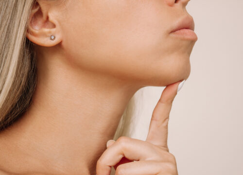 Photo of a woman's chin after a chin wax