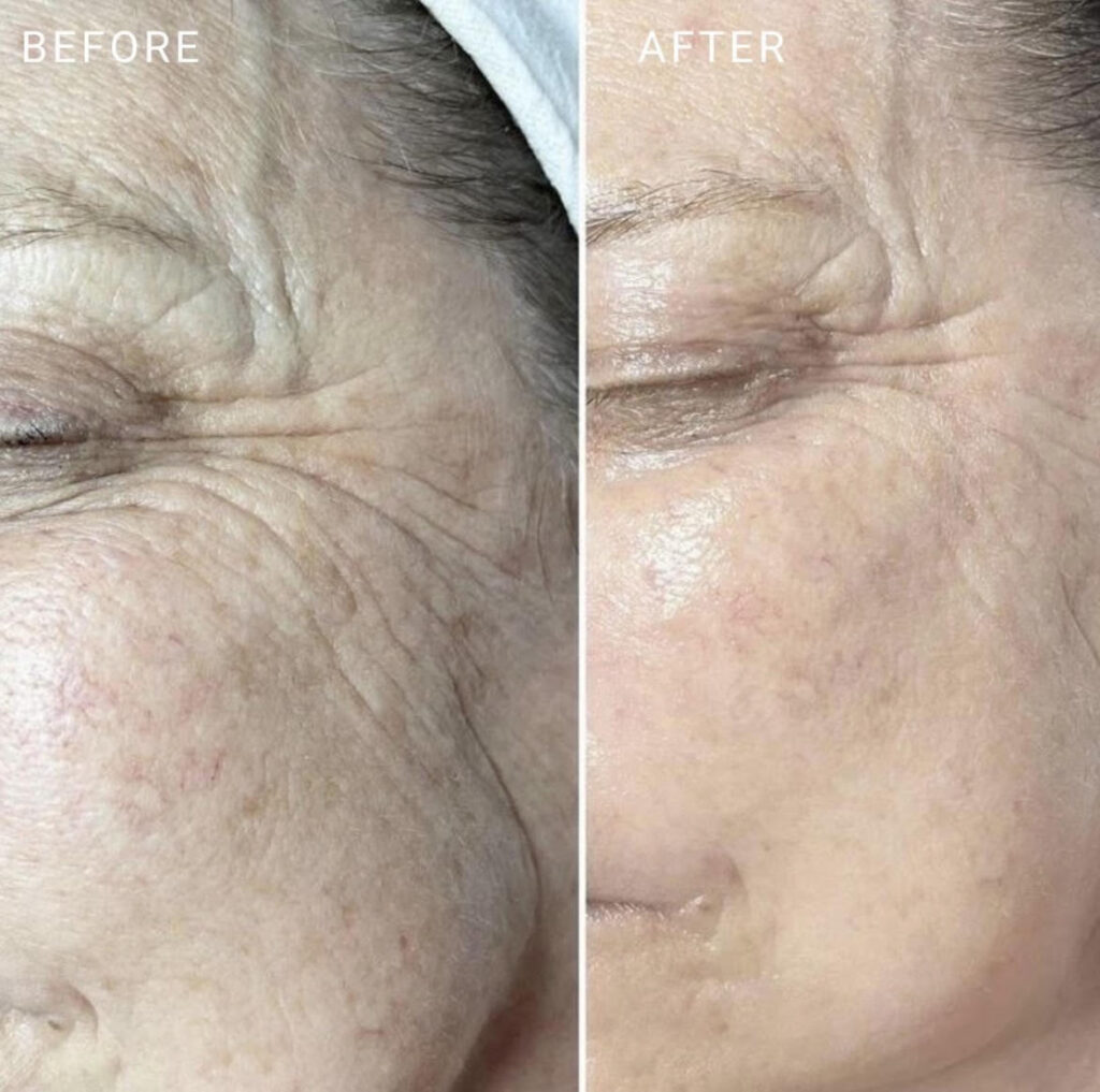 Before and after result photos