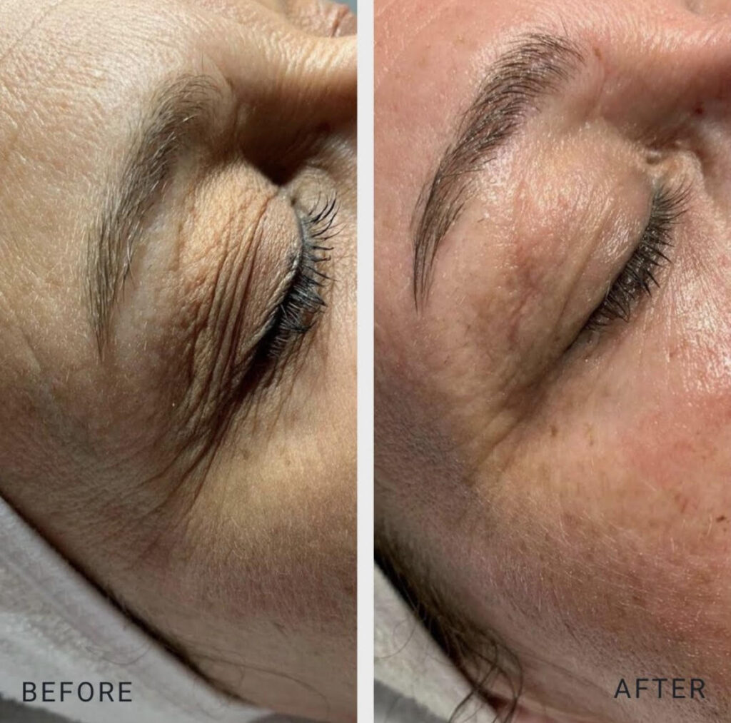 Before and after result photos