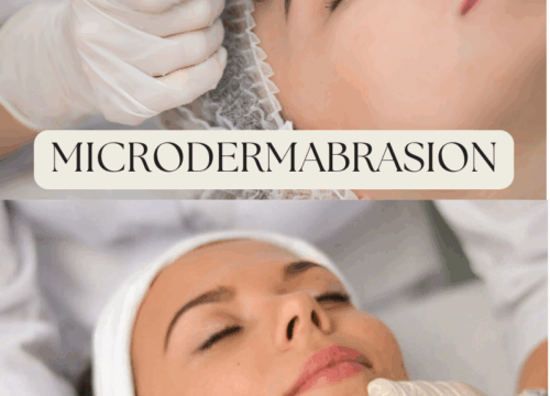 hydrodermabrasion vs microdermabrasion comparison at Lashiqué Studios