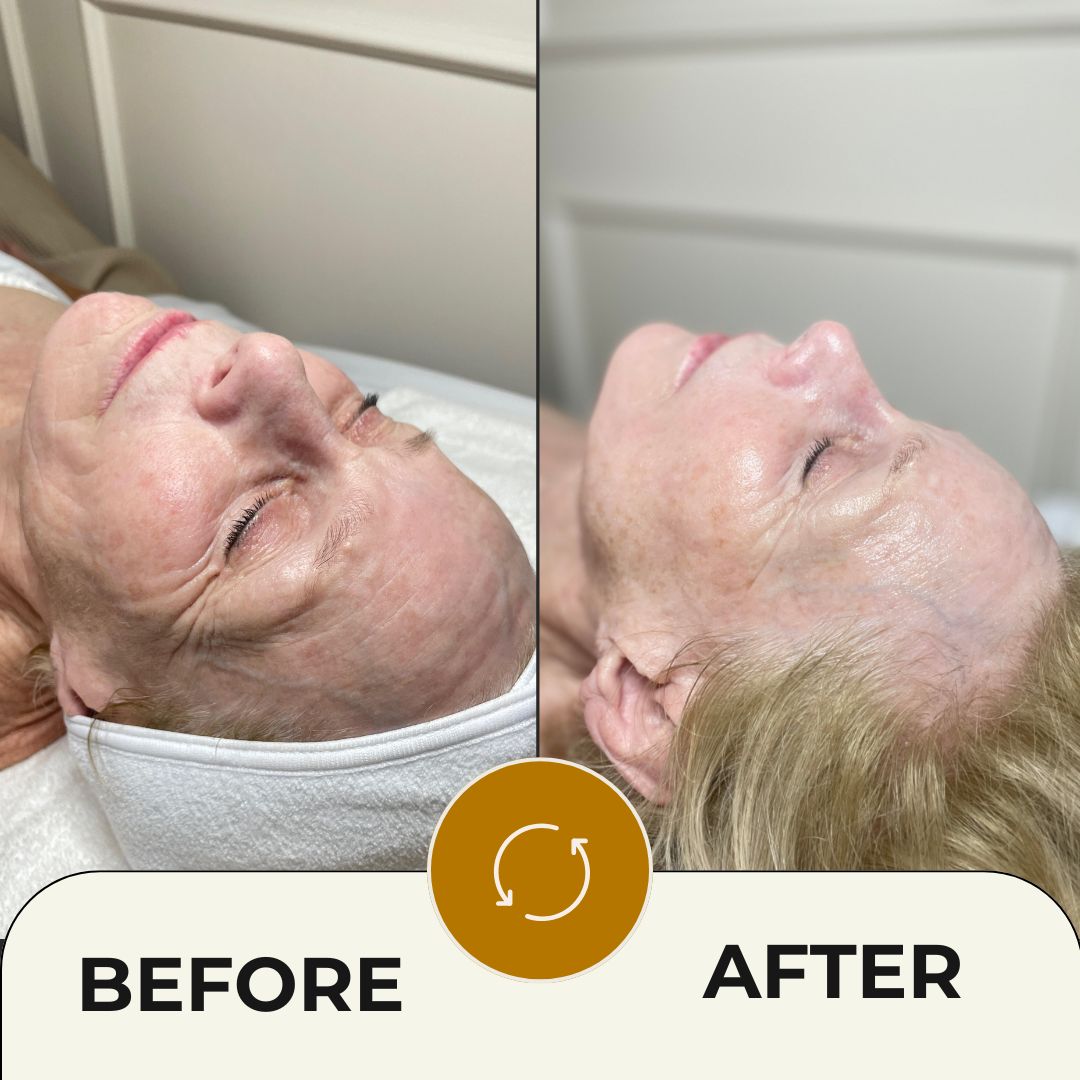 Facials for Anti-Aging: The Truth Behind the Ritual and Their Benefits