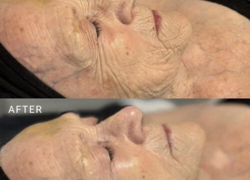 Pro-Aging Skincare at Lashiqué promoting radiant, youthful, and healthy skin through professional facials and advanced treatments.