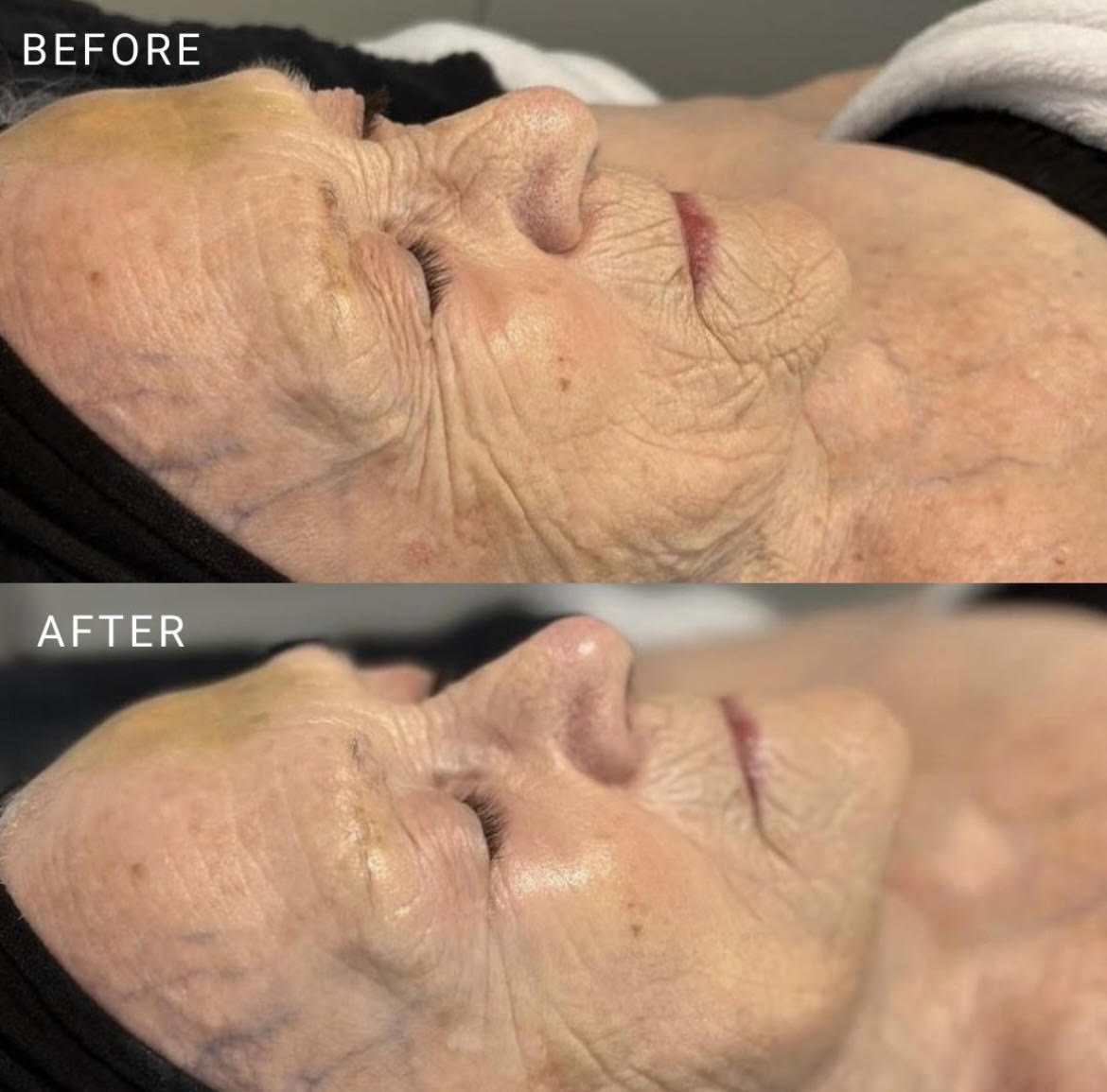 Transform Your Skin with Pro-Aging Skincare: Reveal Radiant, Youthful Results at Lashiqué