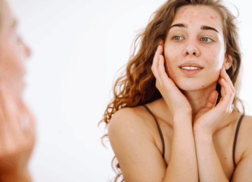 Illustration showing dry, flaky skin during cold weather explaining the truth about winter dry skin and seasonal dehydration.