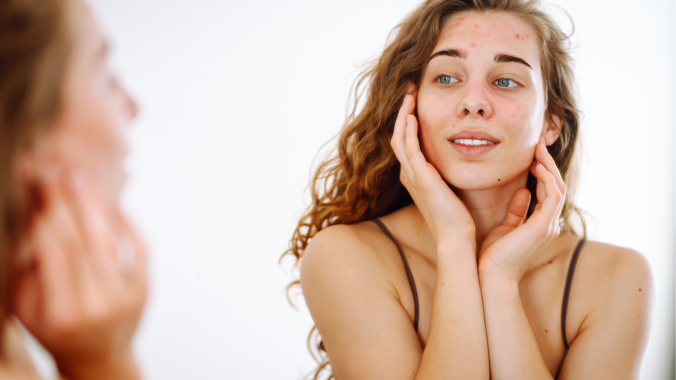 Winter Dry Skin: The Ultimate Breakdown of What Truly Causes Winter Dryness