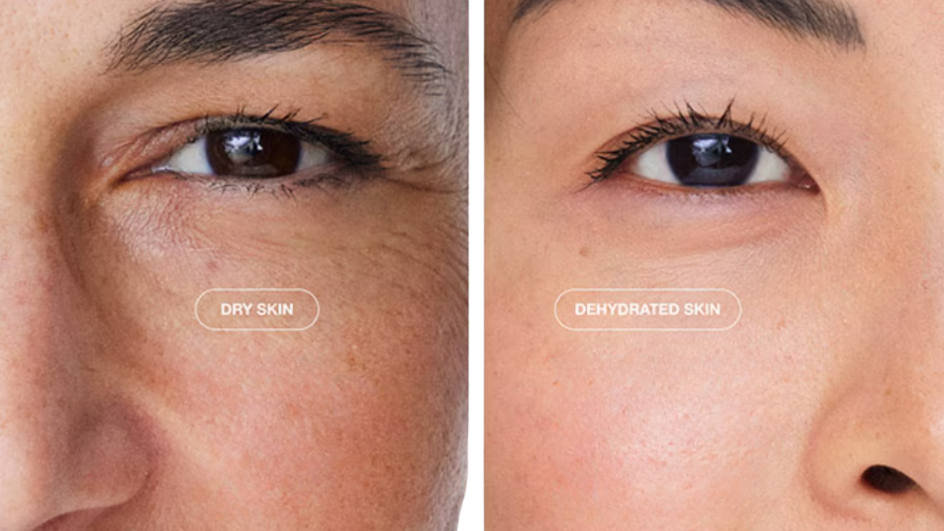 Dry vs Dehydrated Skin: The Essential Guide to Fixing This Common Skin Problem